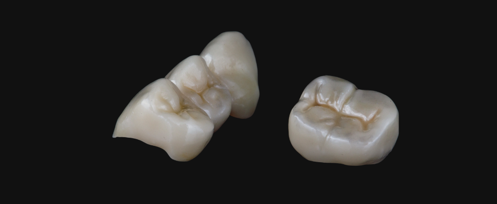 Coroas Dentárias