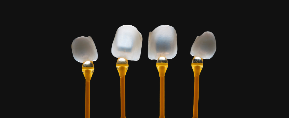 Lentes de Contato Dental